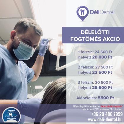 Délelőtti Fogtömés AKCIÓ