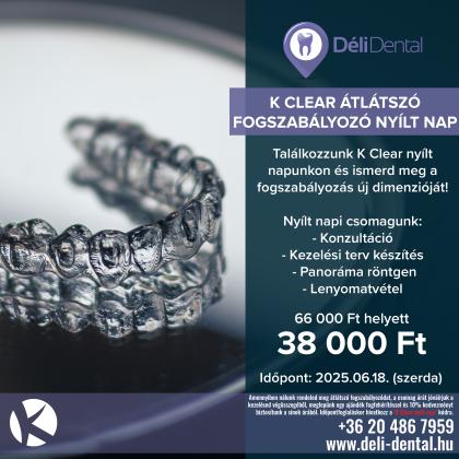 K Clear átlátszó fogszabályozó nyílt nap