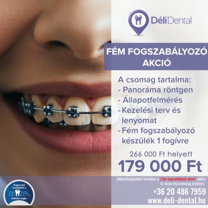 Fém Fogszabályozó Akció