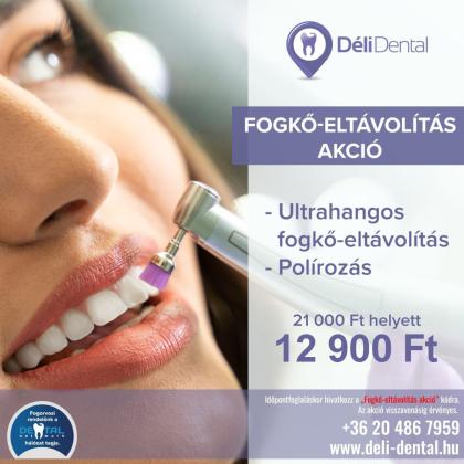 Mosolyfrissítő AKCIÓ