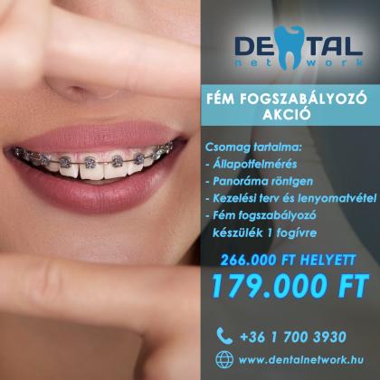 Fém Fogszabályozó Akció