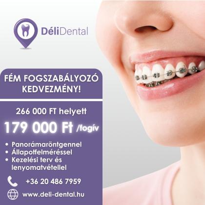 Fém Fogszabályozó Akció
