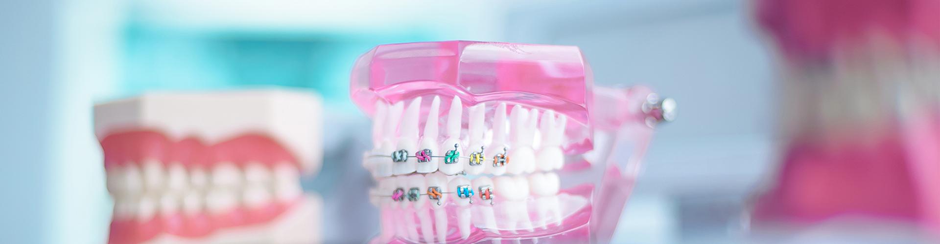 It is never too late to choose orthodontics!