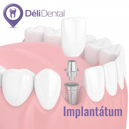 Implantology