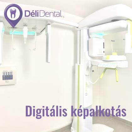Digitális képalkotás - CT - Haifa Dent és Dentium Implant Centerben érhető el Digitális képalkotás - CT - Haifa Dent és Dentium Implant Centerben érhető el