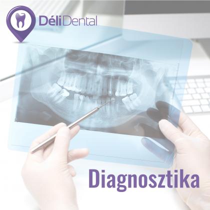 Diagnosztika - a fogászati szűrés fontossága