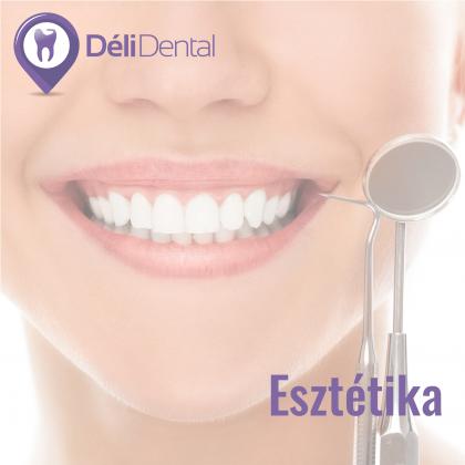Cosmetic Dental Treatments!